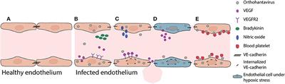 Orthohantavirus Pathogenesis and Cell Tropism